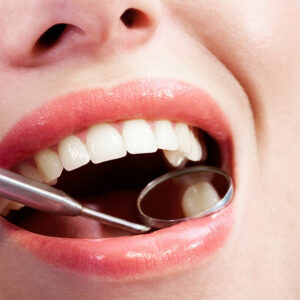 6 dental issues indicating high sugar intake